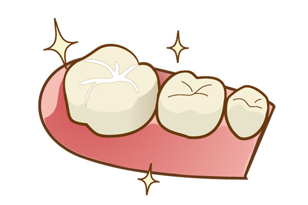 奥歯の溝を虫歯から守る「シーラント」