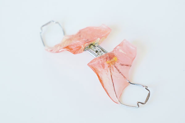 小児矯正（咬合誘導）という考え方