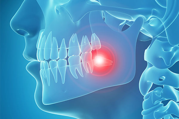 問題が起きる前に計画的な対処を
