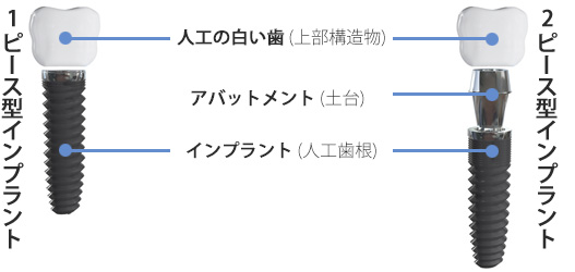 もう一つの安心「マィティス」純国産FDA認可の安全性