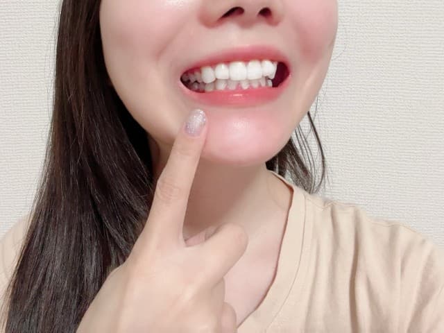 白い歯の女性